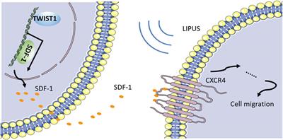 LIPUS as a potential strategy for periodontitis treatment: A review of the mechanisms